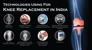 knee replacement
