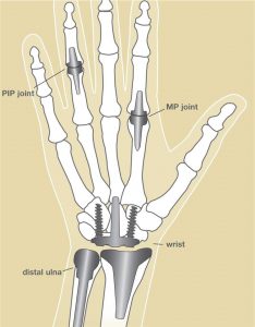 Joint_Image