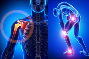 best-orthopedic-surgeon-in-ghazaibad
