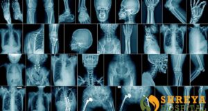 skeleton-bg
