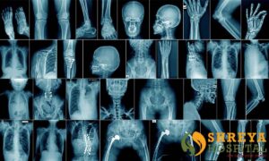 skeleton-bg