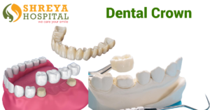 Dental Crown