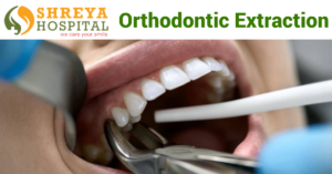 Orthodontic Extraction