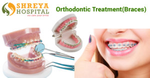 Orthodontic Treatment(Braces)