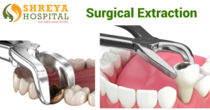 Surgical Extraction