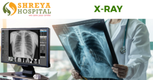 X-Ray