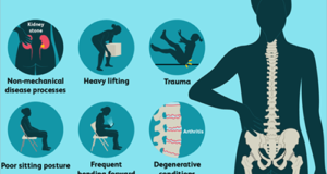 causes-of-back-pain