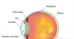 eye-AMD