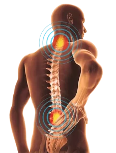 slipped disc