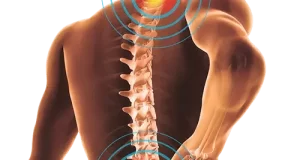 slipped disc